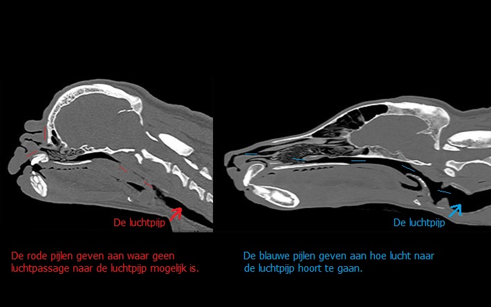 Patella luxatie